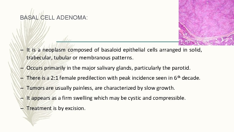 BASAL CELL ADENOMA: – It is a neoplasm composed of basaloid epithelial cells arranged