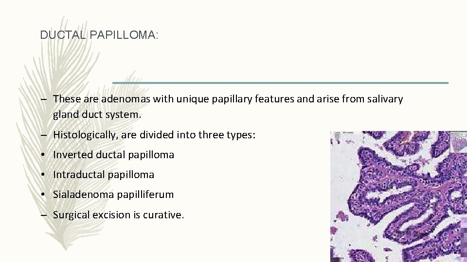 DUCTAL PAPILLOMA: – These are adenomas with unique papillary features and arise from salivary