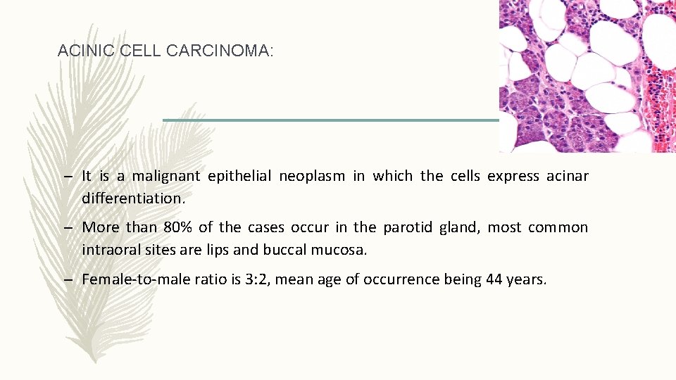 ACINIC CELL CARCINOMA: – It is a malignant epithelial neoplasm in which the cells