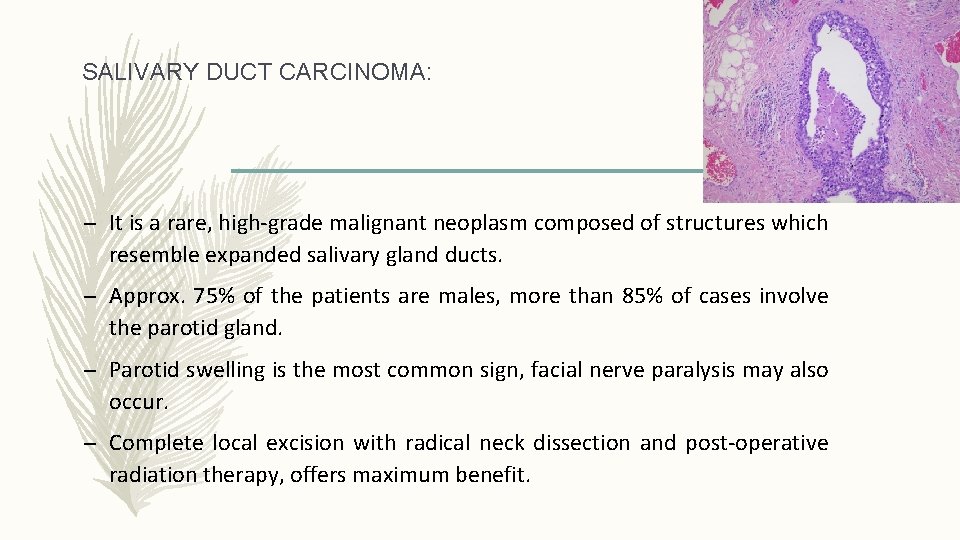 SALIVARY DUCT CARCINOMA: – It is a rare, high-grade malignant neoplasm composed of structures