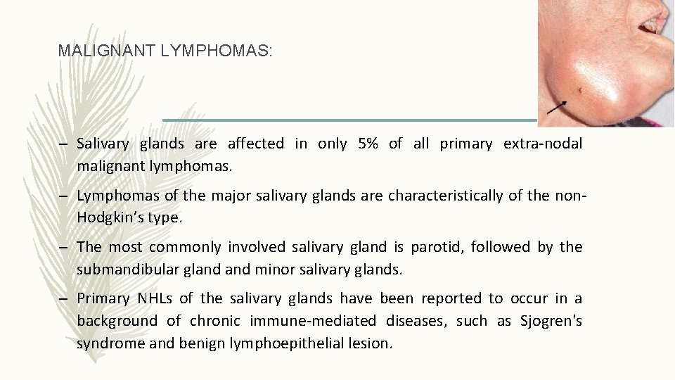 MALIGNANT LYMPHOMAS: – Salivary glands are affected in only 5% of all primary extra-nodal