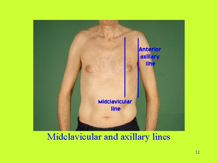 Midclavicular and axillary lines 12  Midclavicular and axillary lines 12