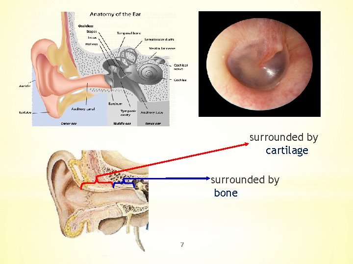 surrounded by cartilage surrounded by bone 7 