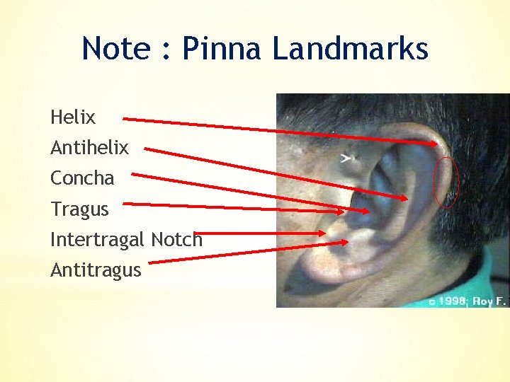 Note : Pinna Landmarks Helix Antihelix Concha Tragus Intertragal Notch Antitragus 