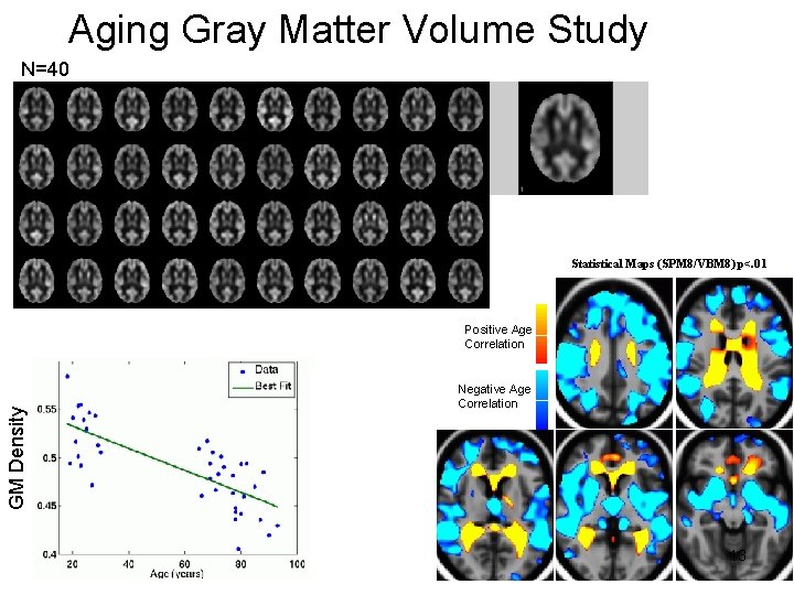 Aging Gray Matter Volume Study N=40 Statistical Maps (SPM 8/VBM 8) p<. 01 GM