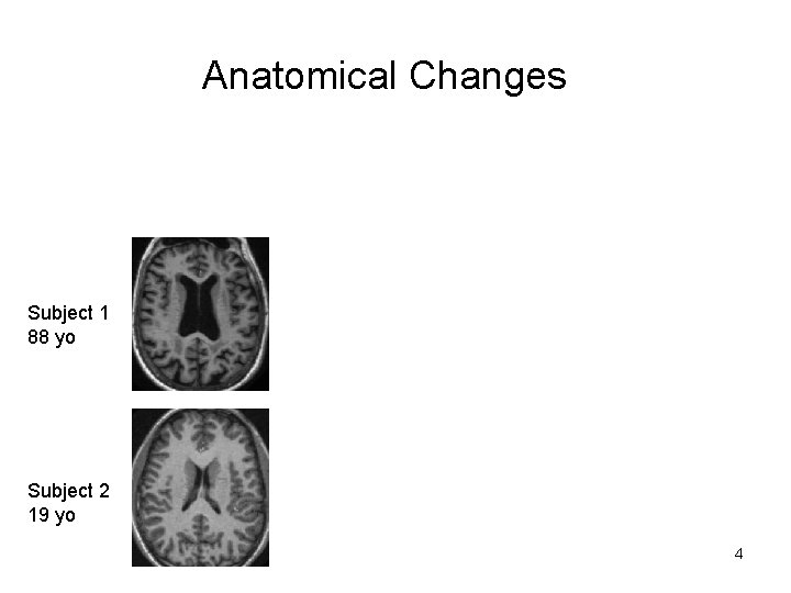 Anatomical Changes GM Subject 1 88 yo Subject 2 19 yo 4 