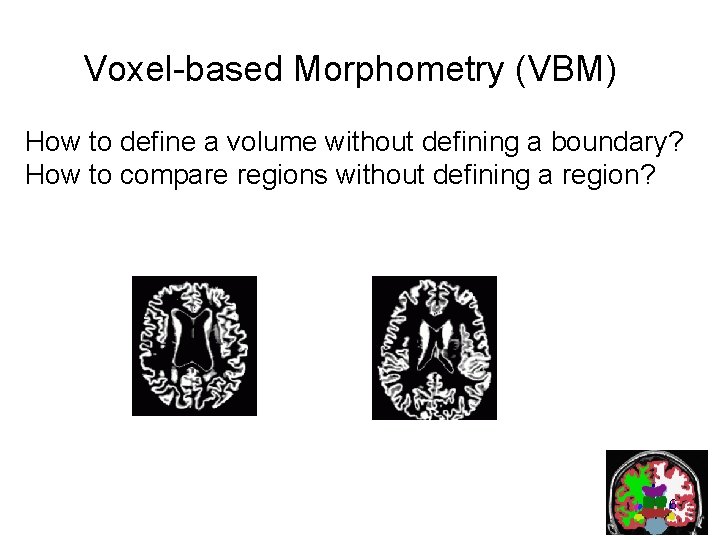 Voxel-based Morphometry (VBM) How to define a volume without defining a boundary? How to