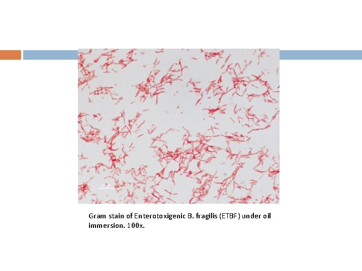 Gram stain of Enterotoxigenic B. fragilis (ETBF) under oil immersion. 100 x. 