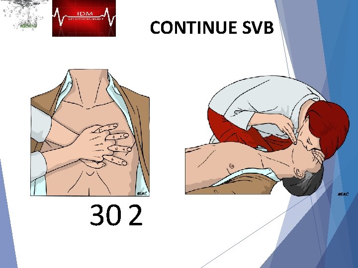 CONTINUE SVB 30 2 