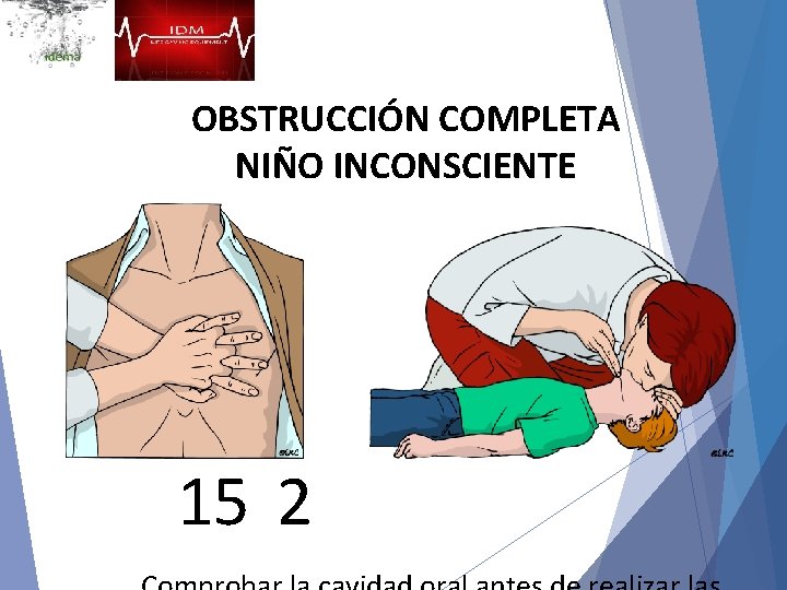 OBSTRUCCIÓN COMPLETA NIÑO INCONSCIENTE 15 2 