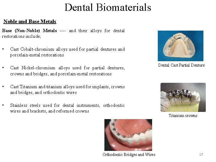 Dental Biomaterials Noble and Base Metals Base (Non-Noble) Metals ---- and their alloys for