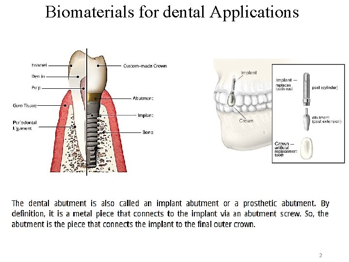 Biomaterials for dental Applications 2 