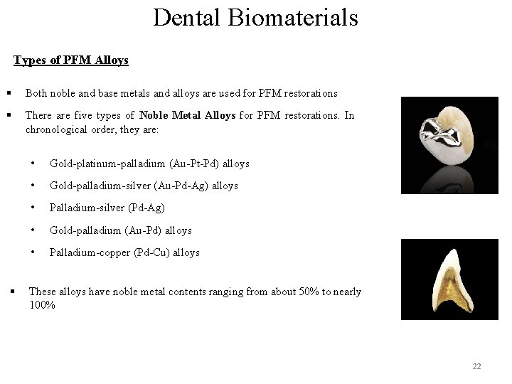 Dental Biomaterials Types of PFM Alloys § Both noble and base metals and alloys