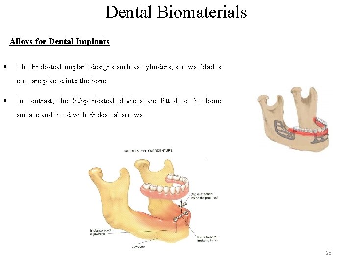 Dental Biomaterials Alloys for Dental Implants § The Endosteal implant designs such as cylinders,
