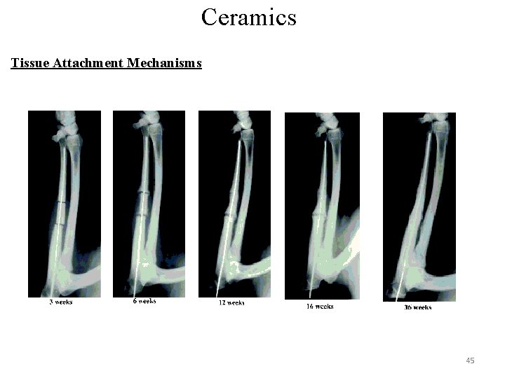 Ceramics Tissue Attachment Mechanisms 45 