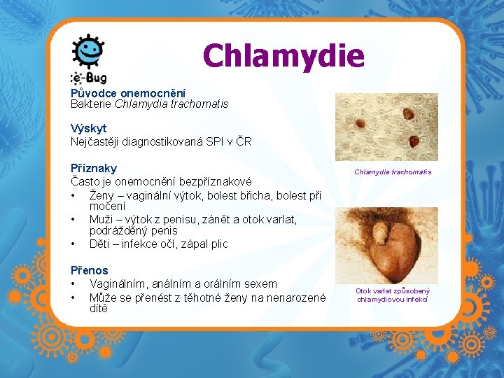 Chlamydie Původce onemocnění Bakterie Chlamydia trachomatis Výskyt Nejčastěji diagnostikovaná SPI v ČR Příznaky Často