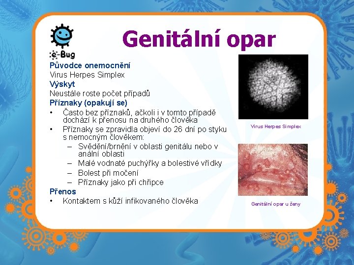 Genitální opar Původce onemocnění Virus Herpes Simplex Výskyt Neustále roste počet případů Příznaky (opakují