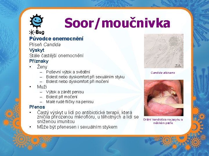 Soor/moučnivka Původce onemocnění Plíseň Candida Výskyt Stále častější onemocnění Příznaky • Ženy – Poševní