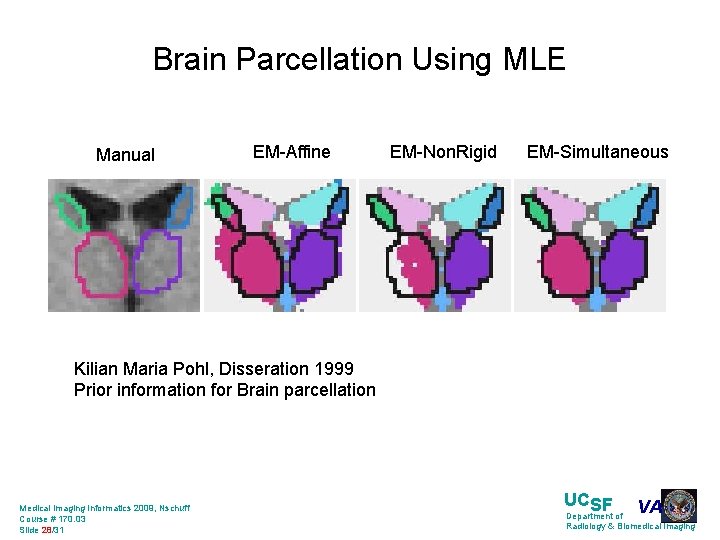 Brain Parcellation Using MLE Manual EM-Affine EM-Non. Rigid EM-Simultaneous Kilian Maria Pohl, Disseration 1999