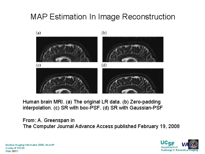 MAP Estimation In Image Reconstruction Human brain MRI. (a) The original LR data. (b)