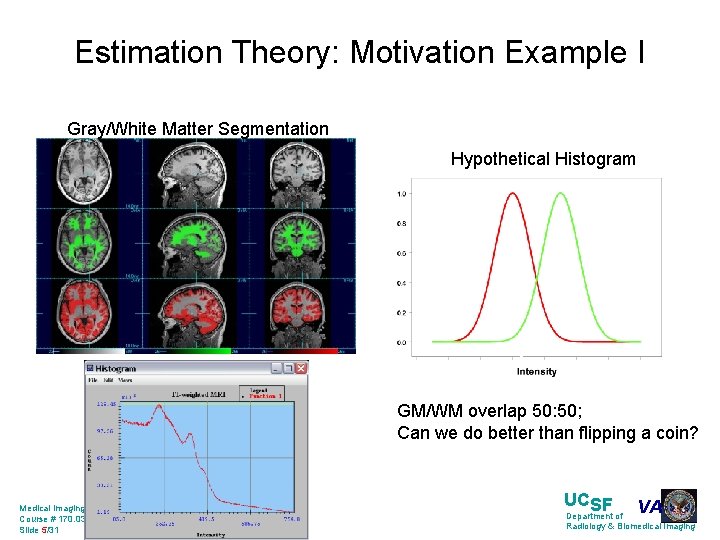 Estimation Theory: Motivation Example I Gray/White Matter Segmentation Hypothetical Histogram GM/WM overlap 50: 50;