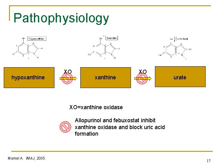 Pathophysiology hypoxanthine XO urate XO=xanthine oxidase Allopurinol and febuxostat inhibit xanthine oxidase and block