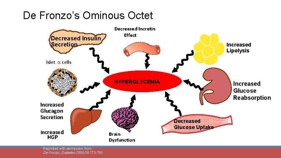 De Fronzo’s Ominous Octet Decreased Insulin Secretion Decreased Incretin Effect Increased Lipolysis Islet cells