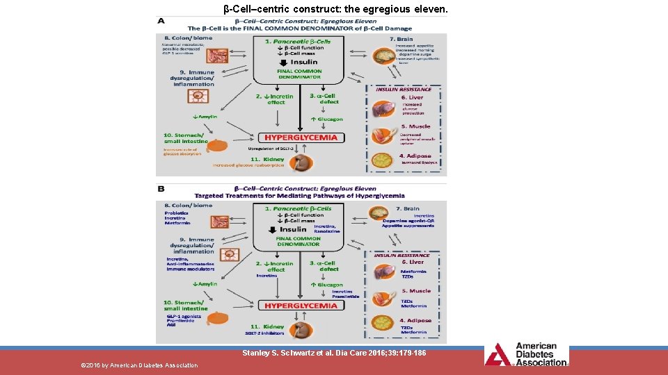 β-Cell–centric construct: the egregious eleven. Stanley S. Schwartz et al. Dia Care 2016; 39: