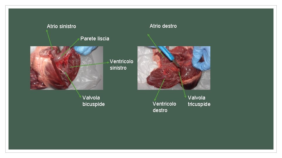 Atrio destro Atrio sinistro Parete liscia Ventricolo sinistro Valvola bicuspide Ventricolo destro Valvola tricuspide