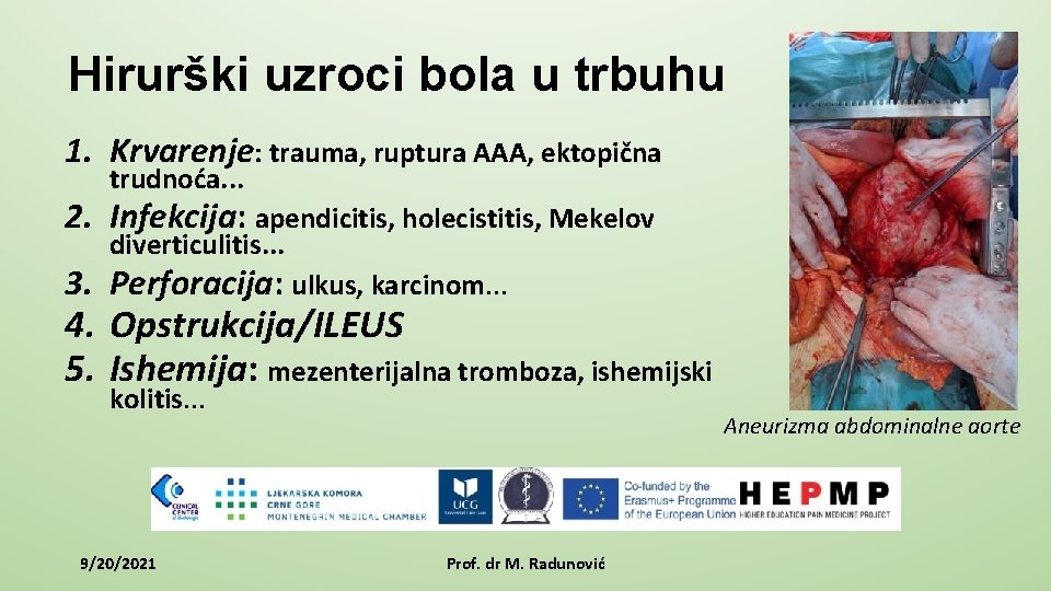 Hirurški uzroci bola u trbuhu 1. Krvarenje: trauma, ruptura AAA, ektopična trudnoća. . .