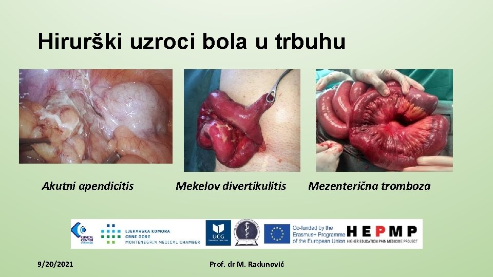Hirurški uzroci bola u trbuhu Akutni apendicitis 9/20/2021 Mekelov divertikulitis Prof. dr M. Radunović