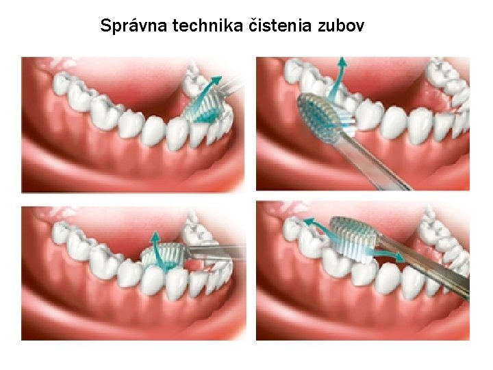 Správna technika čistenia zubov Správna technika čistenia zubov