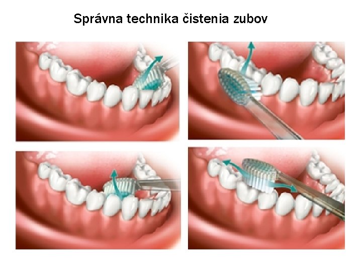 Správna technika čistenia zubov 