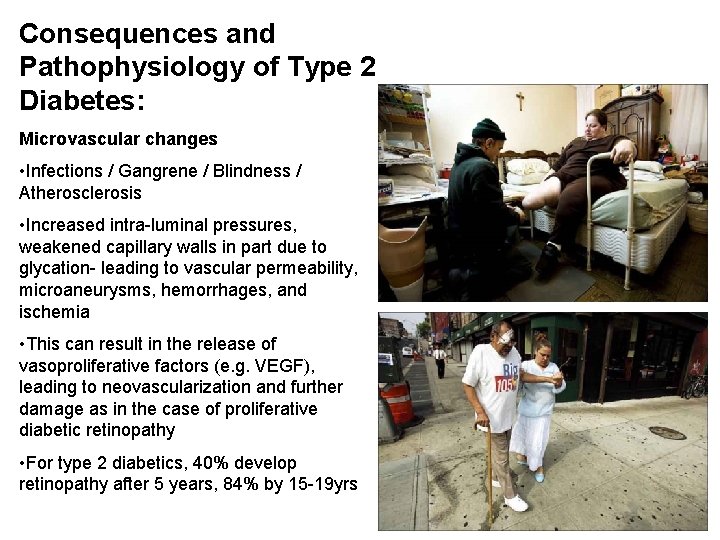 Consequences and Pathophysiology of Type 2 Diabetes: Microvascular changes • Infections / Gangrene /