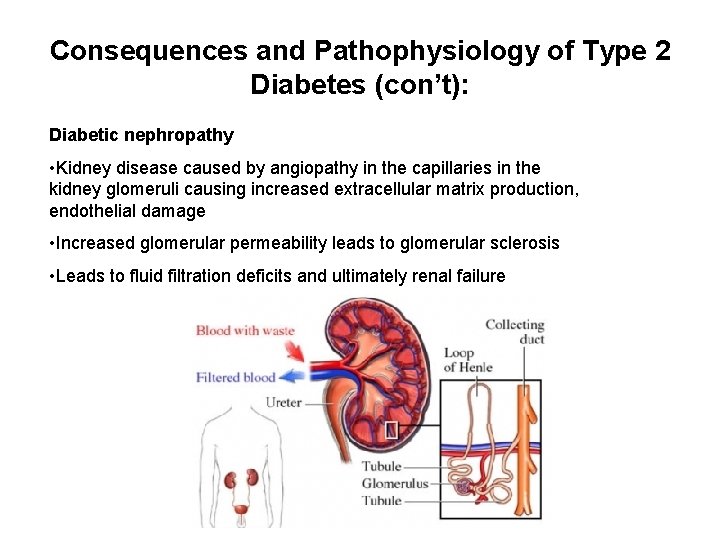 Consequences and Pathophysiology of Type 2 Diabetes (con’t): Diabetic nephropathy • Kidney disease caused