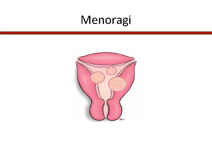 Menoragi 