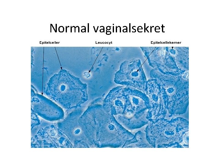Normal vaginalsekret 