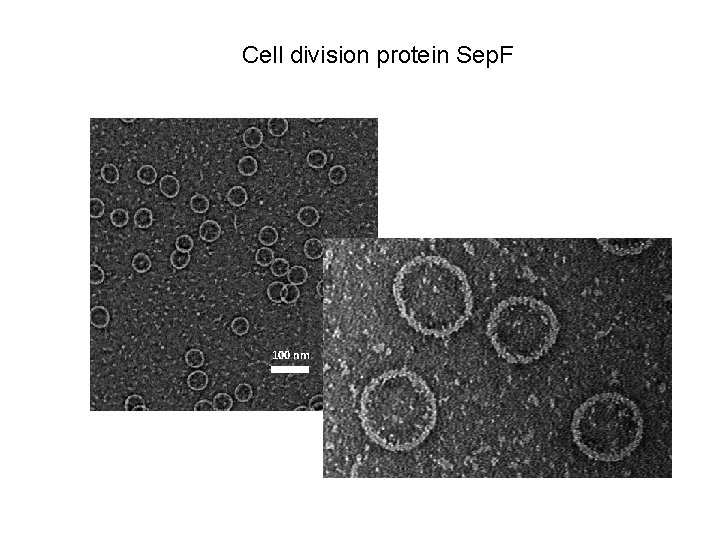 Cell division protein Sep. F 100 nm 