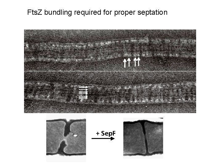 Fts. Z bundling required for proper septation + Sep. F 