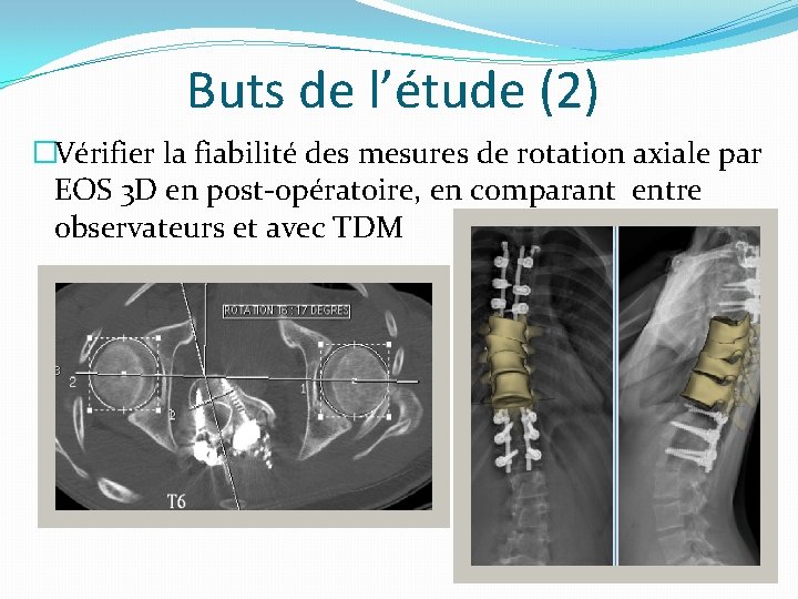 Buts de l’étude (2) �Vérifier la fiabilité des mesures de rotation axiale par EOS