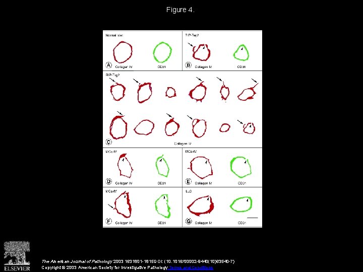 Figure 4. The American Journal of Pathology 2003 1631801 -1815 DOI: (10. 1016/S 0002