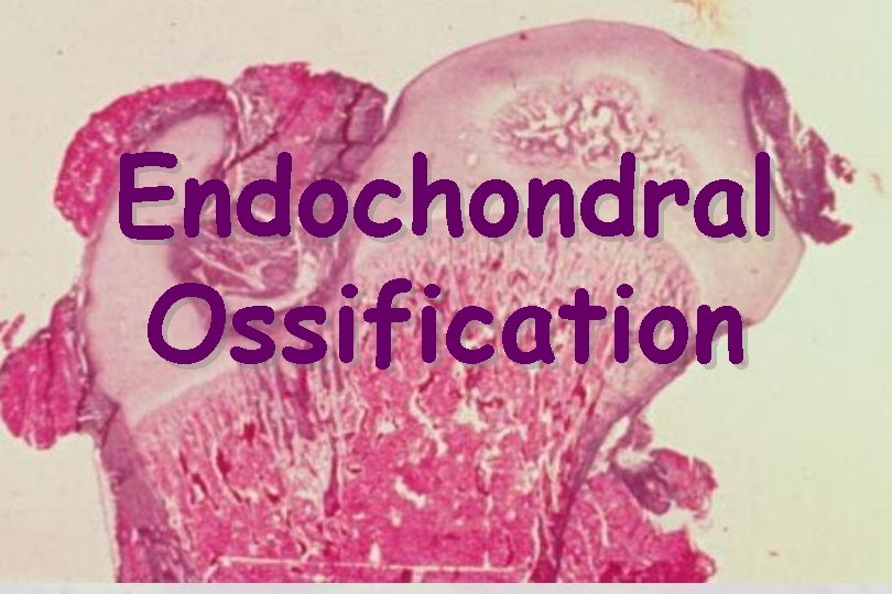 Endochondral Ossification 