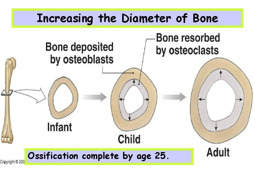 Increasing the Diameter of Bone Ossification complete by age 25. 