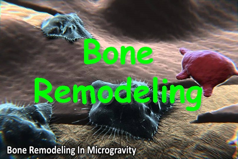 Bone Remodeling 