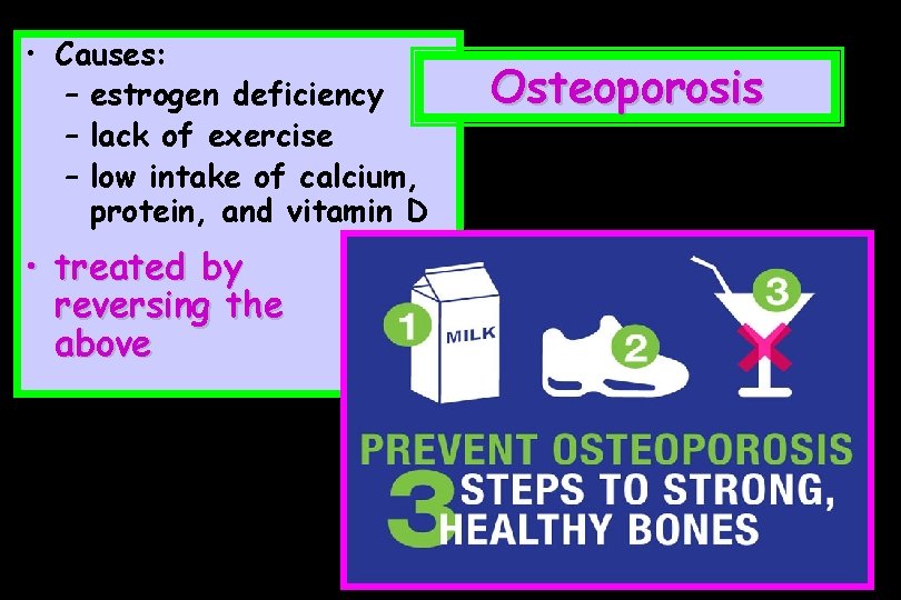  • Causes: – estrogen deficiency – lack of exercise – low intake of