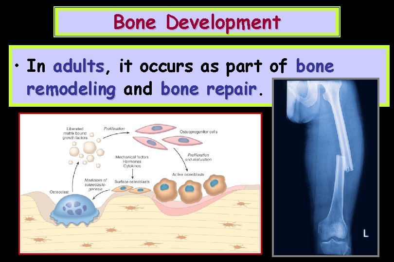 Bone Development • In adults, adults it occurs as part of bone remodeling and
