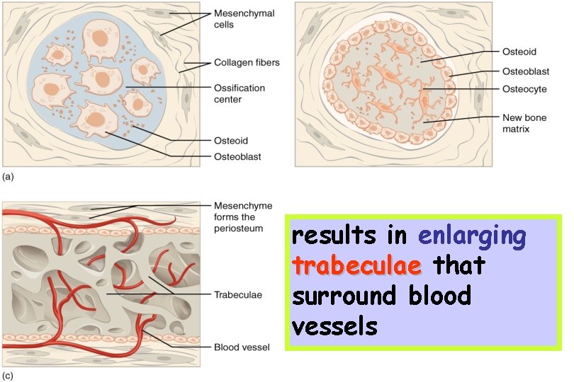 results in enlarging trabeculae that surround blood vessels 