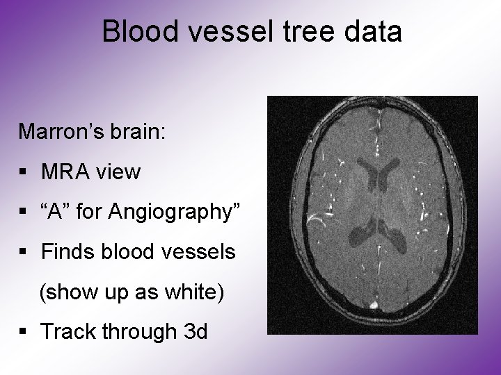 Blood vessel tree data Marron’s brain: § MRA view § “A” for Angiography” §