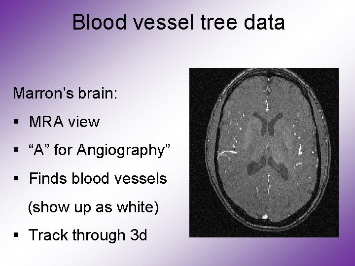 Blood vessel tree data Marron’s brain: § MRA view § “A” for Angiography” §