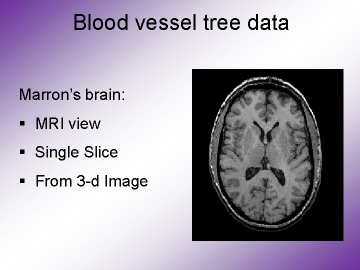 Blood vessel tree data Marron’s brain: § MRI view § Single Slice § From